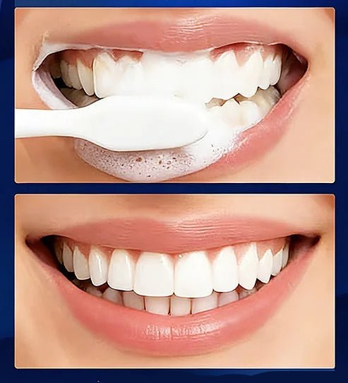 Dentifrice blanchissante de 100g - Nettoyage en profondeur - vente privée <none>