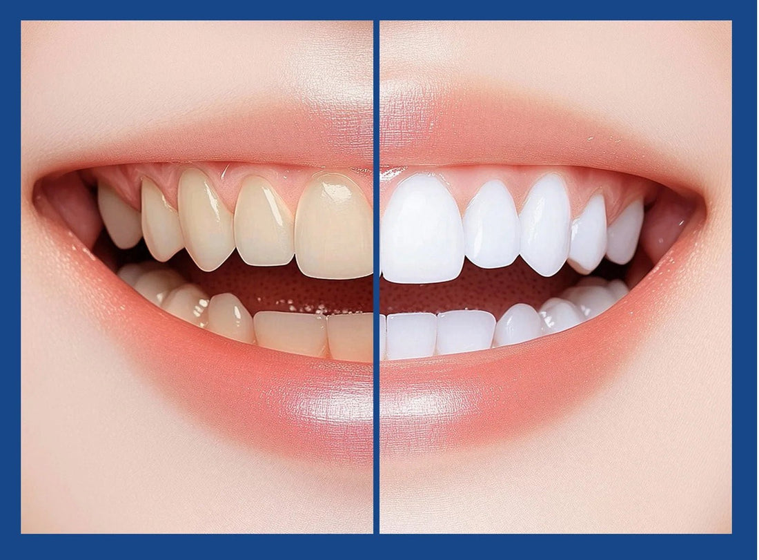 Dentifrice de blanchiment dentaire - vente privée 14:29100g;5:570000352pcs