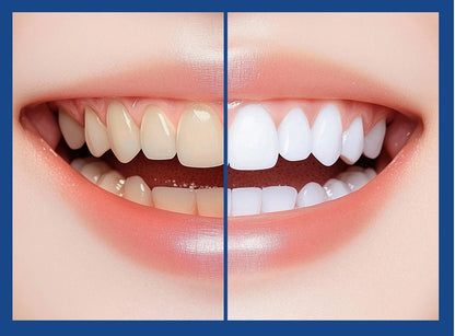 Dentifrice de blanchiment dentaire - vente privée 14:29100g;5:570000352pcs