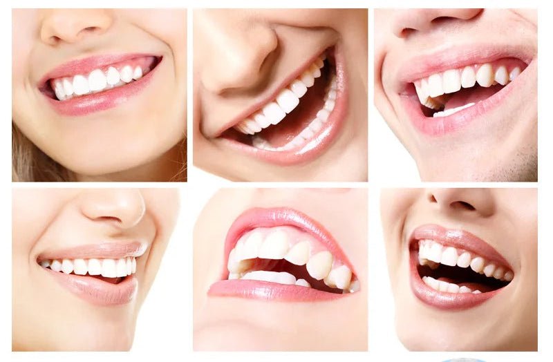 Stylo blanchisseur pour les dents - vente privée 14:1731PC