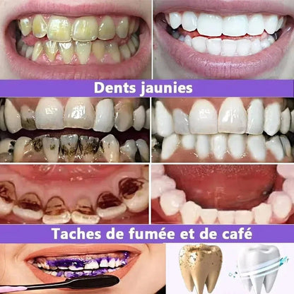 Stylo blanchisseur pour les dents - vente privée 14:1731PC