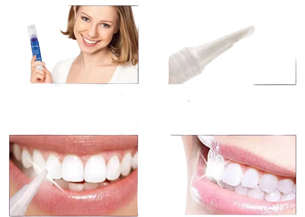 Stylo blanchisseur pour les dents - vente privée 14:1731PC