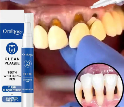 Stylo blanchisseur pour les dents - vente privée 14:1731PC