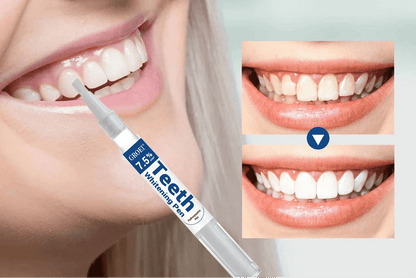 Stylo de blanchiment dentaire pour soins hygiène - vente privée 14:1735ML